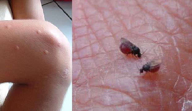 跟蚊子一样可恶的虫子－吸血蠓|消灭蠓虫|防治害虫|防治害虫服务