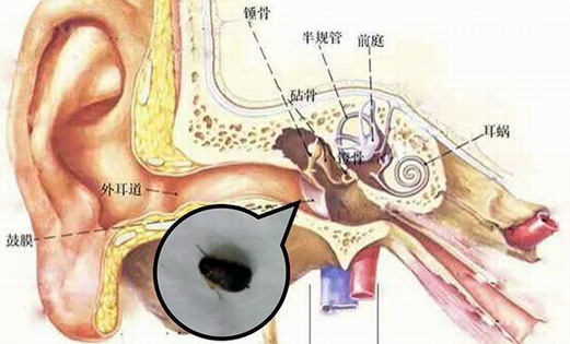 蟑螂进入耳朵的概率大吗|灭蟑|广州灭蟑