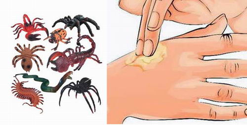 关于动物或昆虫的咬伤处理|康雅杀虫|广州杀虫